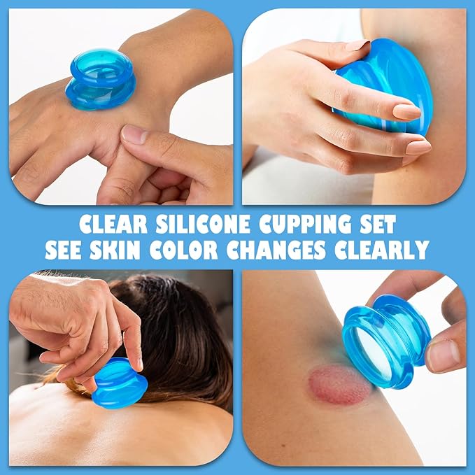 7Pcs Cupping Therapy Set-Professional Silicone Cupping, Suitable for Facial Body Massage/Deep Myofascial Release/Pain Relief/Muscle Relaxation & More (Blue,7pcs)-CasaMuseHome