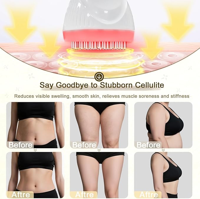 2025 Upgraded Lymphatic Drainage Massager Body Sculpting Machine Helps Reduce Stretch Marks & Cellulite for Legs, Arms & Belly Anti Cellulite Massage Tool with Light Heat & Vibration-CasaMuseHome