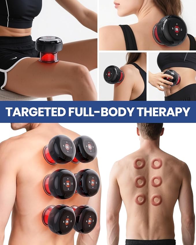 5-in-1 Electric Cupping Kit for Massage Therapy with Red Light Therapy - 24 Levels of Adjustable Suction & Heat, Portable Cupping Therapy Set for Back Pain Relief & Neck Muscle Soreness-CasaMuseHome
